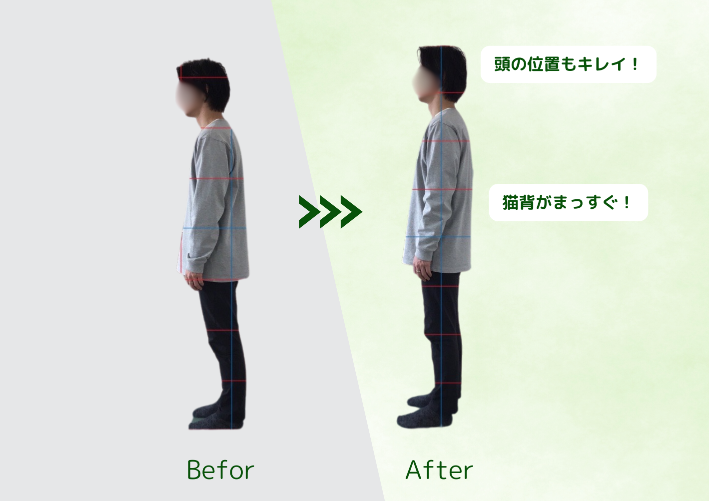 姿勢改善（Before → After）