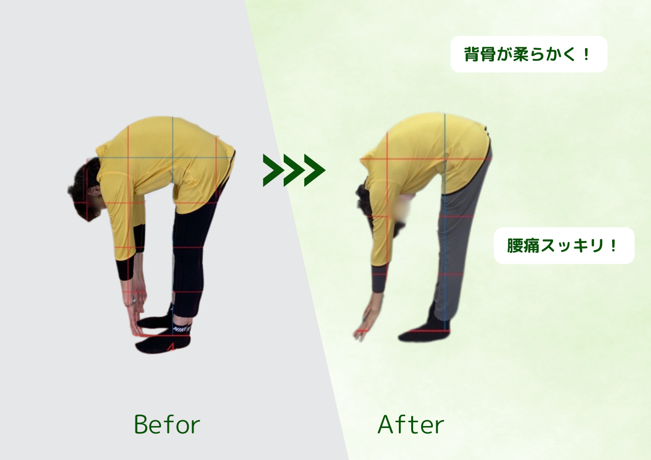 猫背の改善